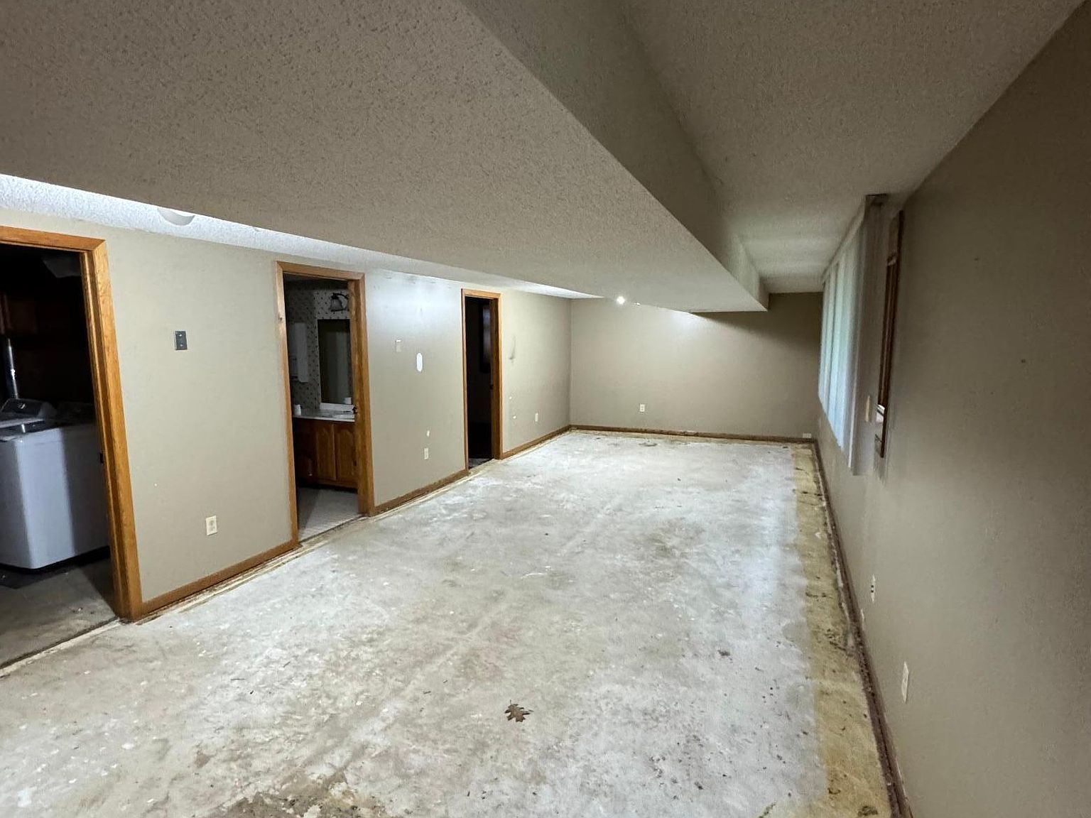 15171 Elm Dr Detroit Lakes, MN 56501  | Single Family