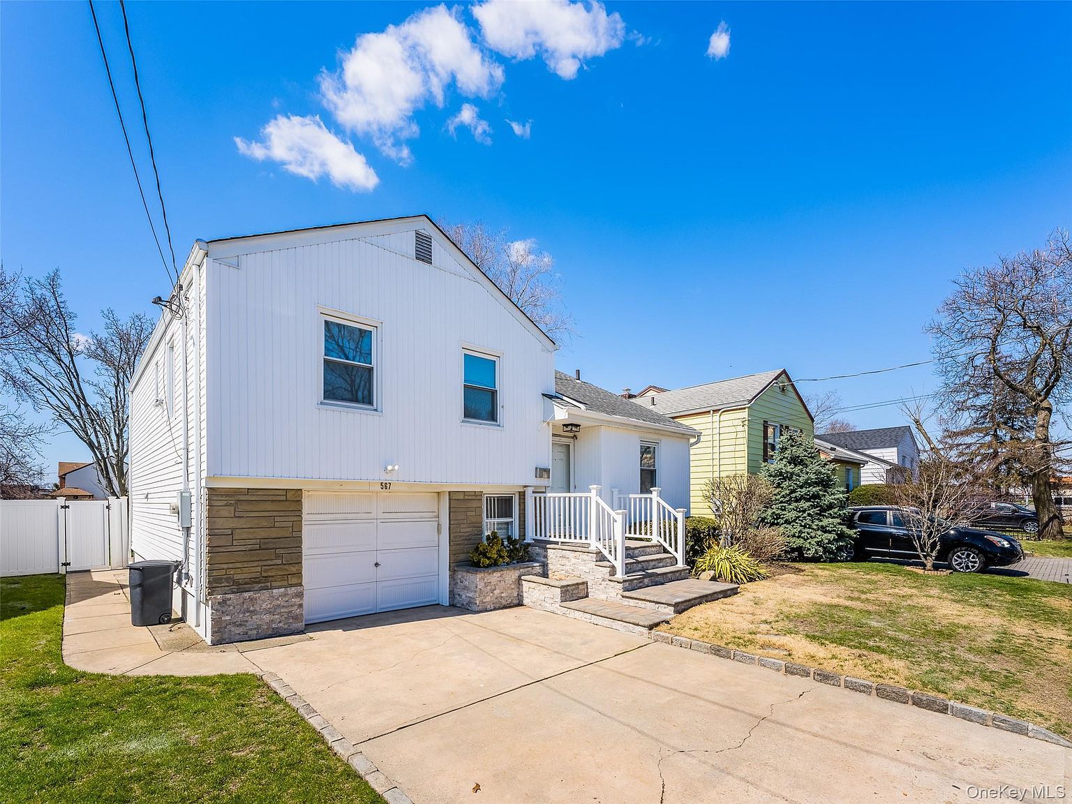 567 Oxford Rd Cedarhurst, NY 11516 - Thumbnail 3